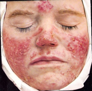 Wrinkles from Saksoline Beauty Women