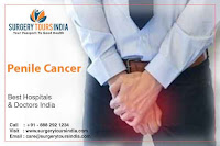  Penile Cancer Treatment In India