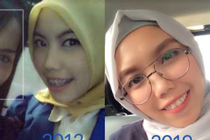 10 Year Challenge, Bagaimana Wajah Anda 10 Tahun yang Lalu?