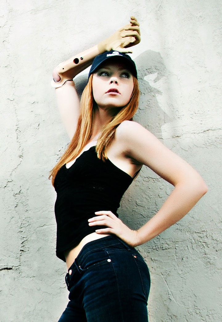 Prosthetic leg below knee cost picture