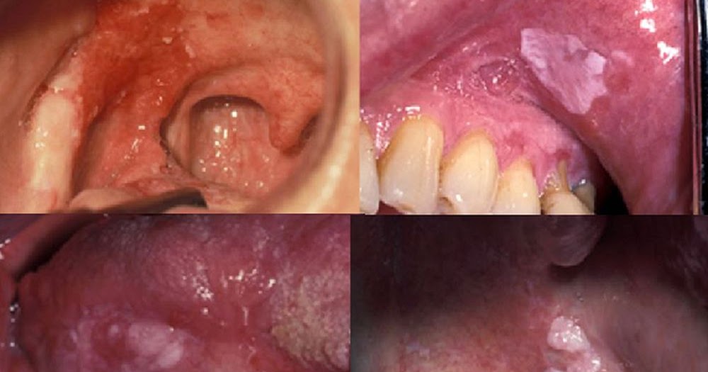 oral pathology oral pathology
