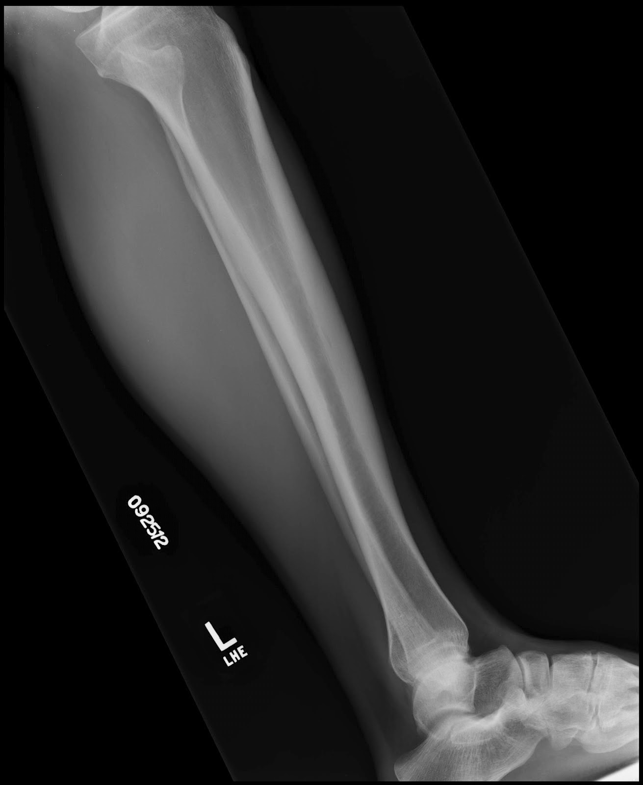 PINTA PARADE Fractured