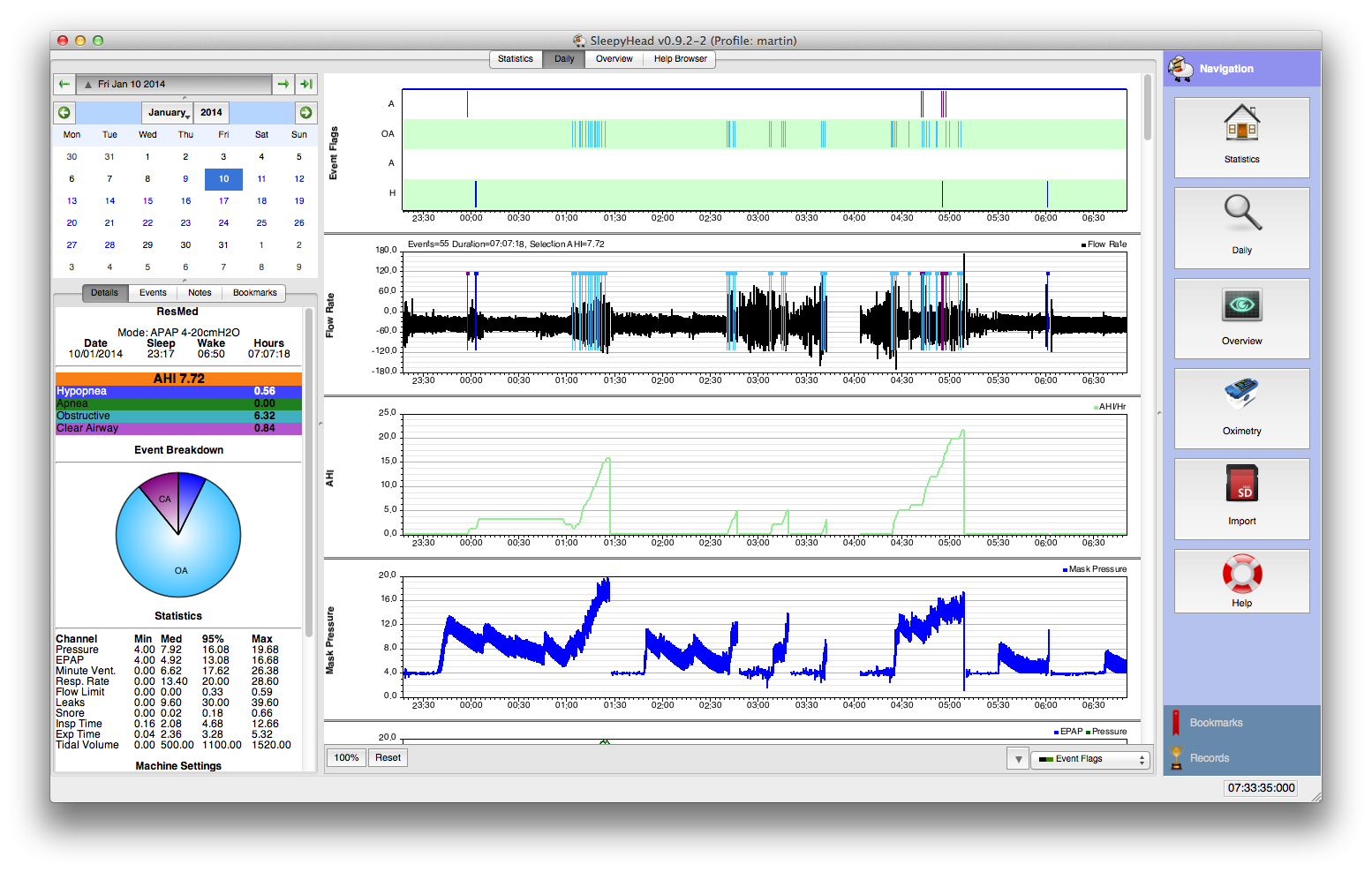 Resmed vs Respironics | Apnea Board