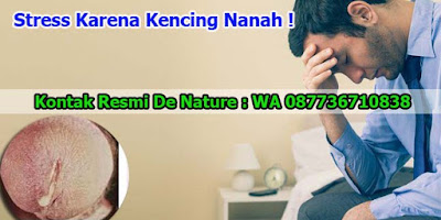Kelamin Keluar Nanah Dan Cara Mudah Mengatasinya Dengan Cepat Kelamin Keluar Nanah Dan Cara Mudah Mengatasinya Dengan Cepat