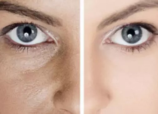 Cara Mengecilkan Pori Pori Di Wajah Secara Alami Sehatdaily