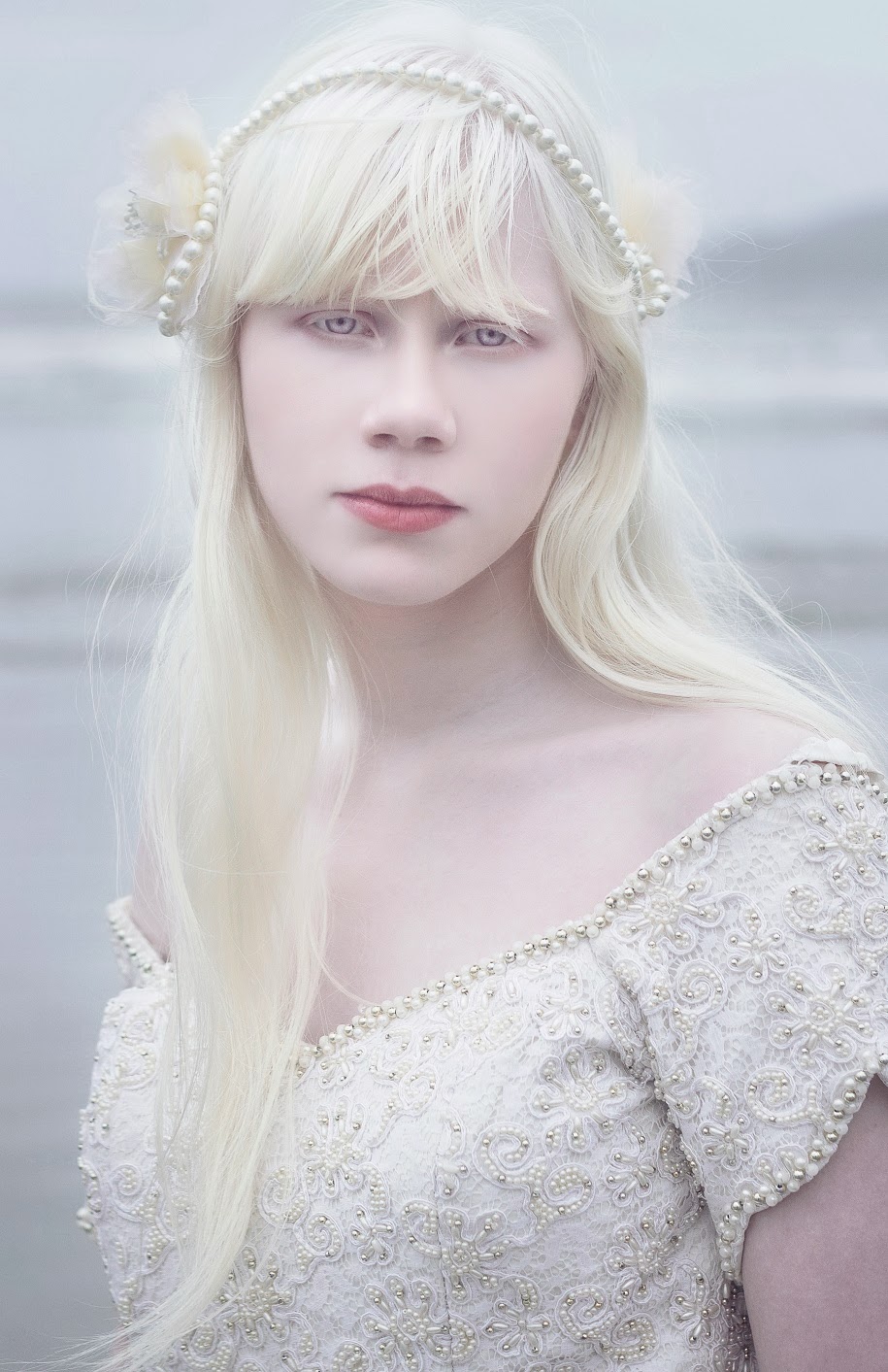 Albino Beauty on Pinterest | Albinism, Shaun Ross and Albino Model
