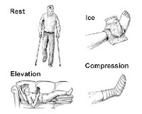 Rest, Ice, Compression, Elevation