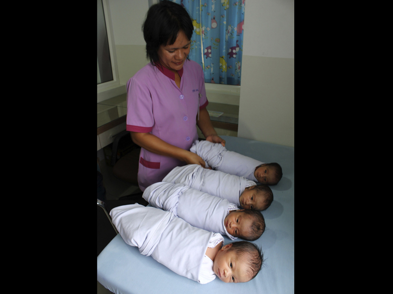 FOTO: Bayi Kembar Empat Lahir di Medan  Info Menarik