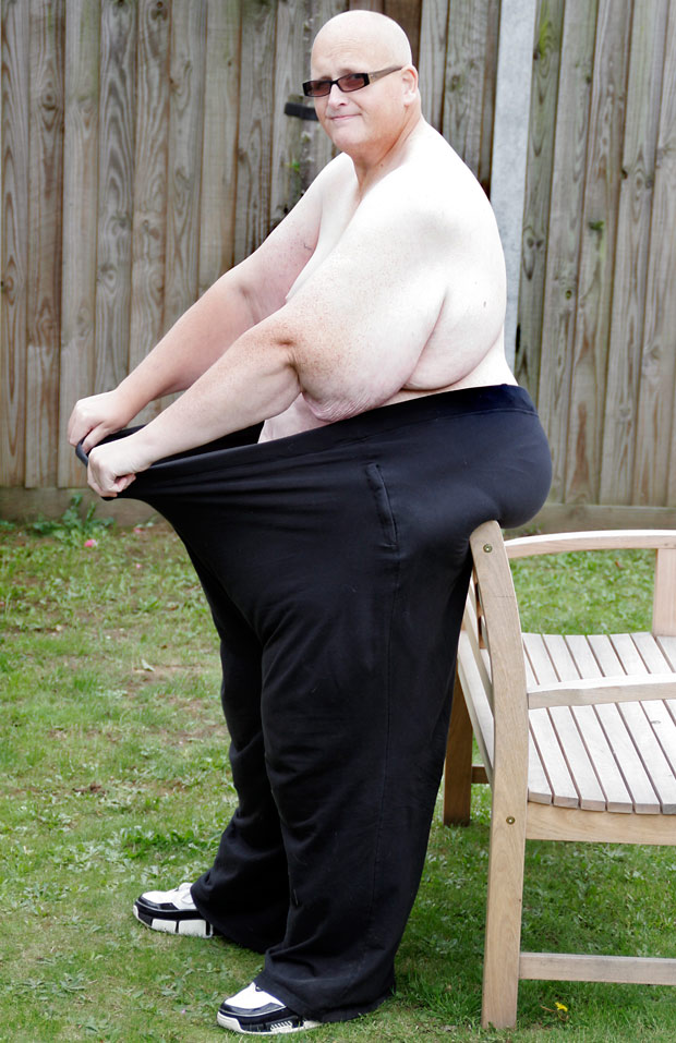 World s Fattest Man Loses 285 Kg But Now Requires Operation To Get Rid world-s-fattest-man-loses-7st-in-7-months-this-is-how-daily-star