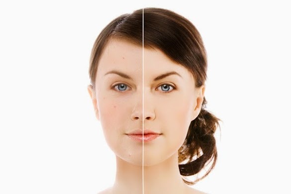 Merawat Wajah Sesuai Jenis Kulit