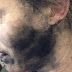 A Lady's Headphone Explodes During Flight Leaving The Victim With Burns
