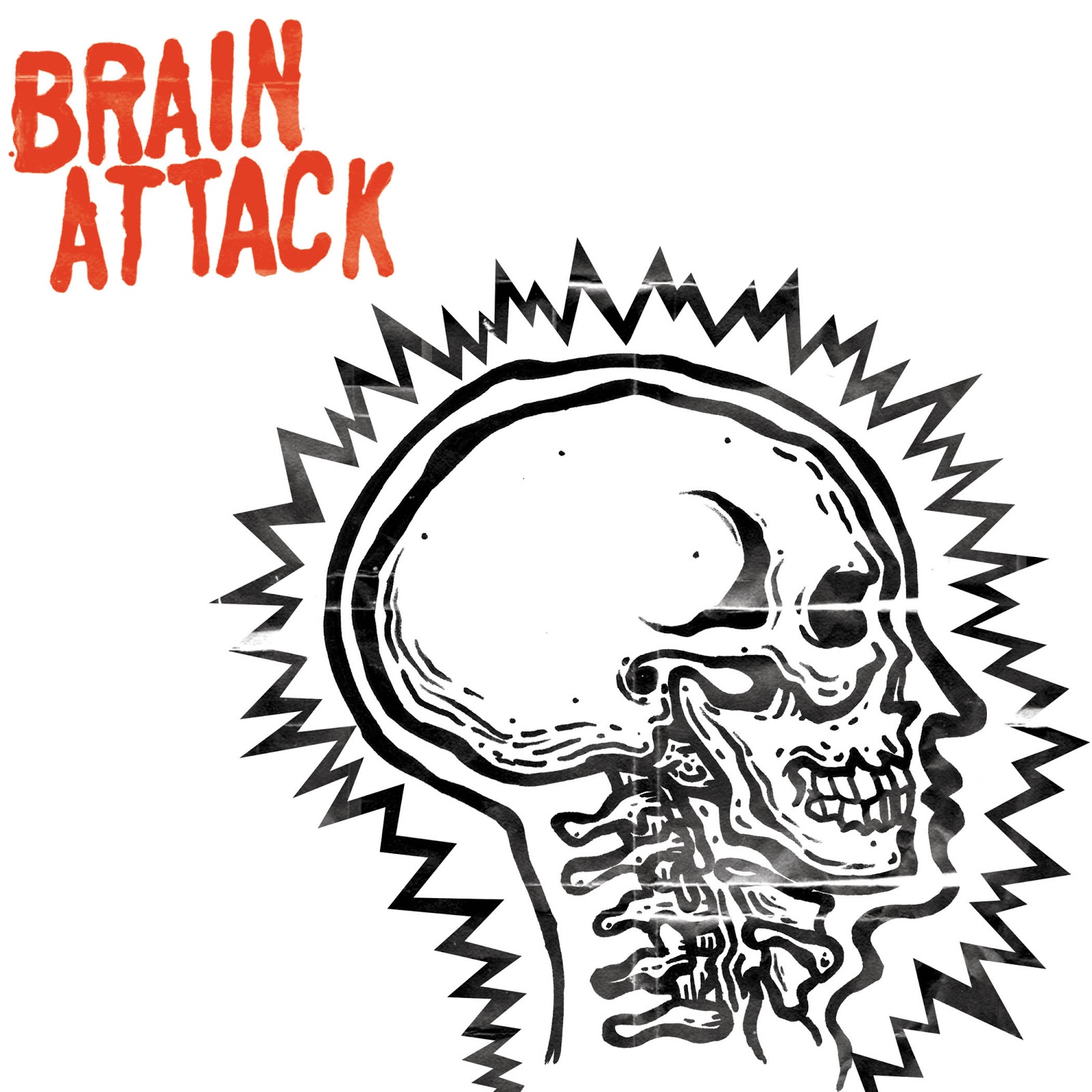 Brain attack. Sick Brain.