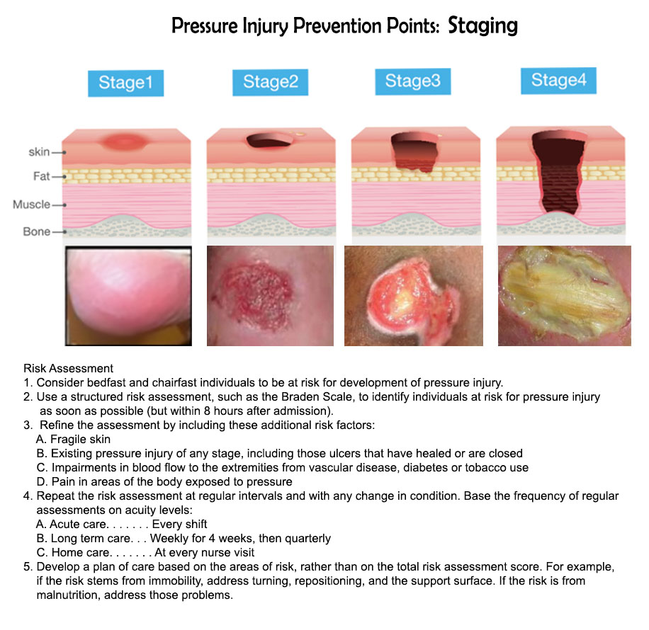 Dietitians Online Blog: Pressure Ulcer Awareness - Pressure Injury ...