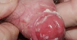 Como se refieren las muchachas a los pequeños penes