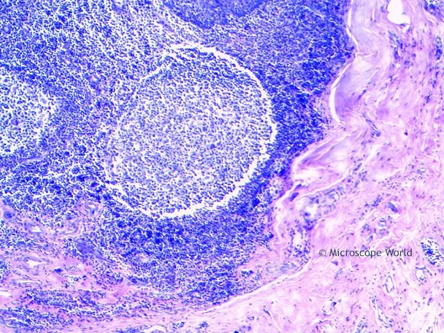 Microscope World image of palatine tonsil cross section under the microscope at 100x.