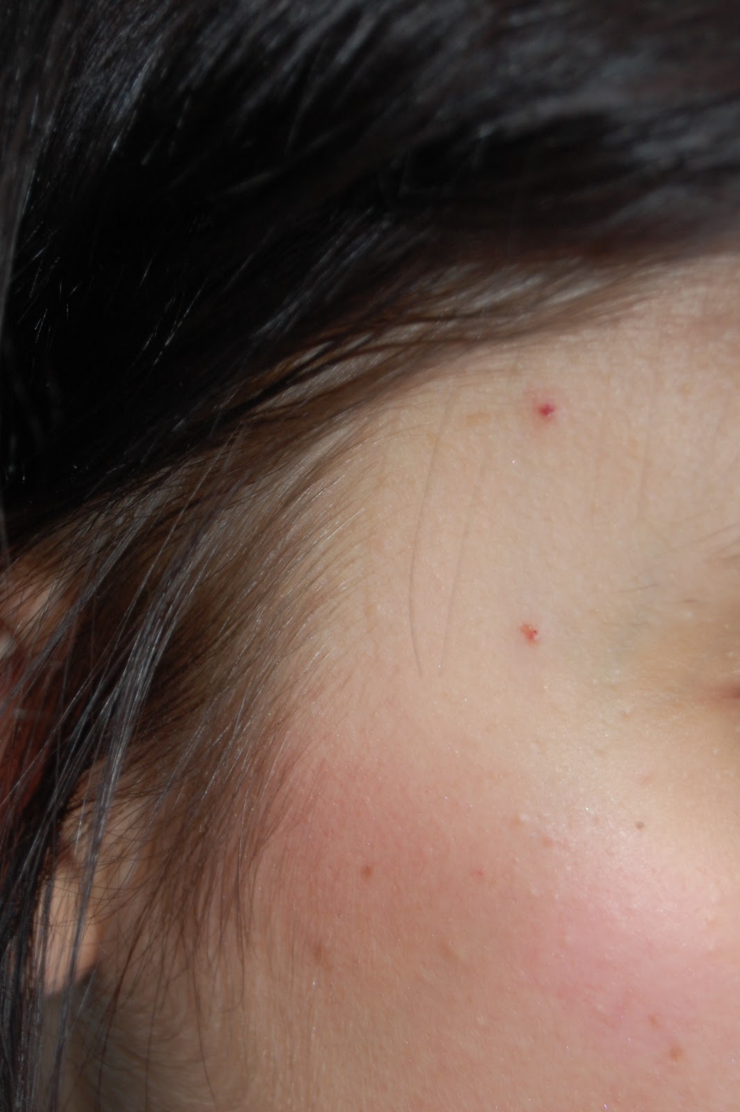 beclounor-md-formulations-annoying-little-white-spots