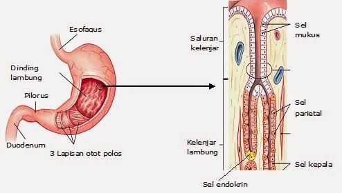 Penyakit yang menyebabkan lambatnya feses menuju usus besar, karena kurangnya makanan berserat adala