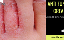 Anti Fungal Treatment | JRK Research