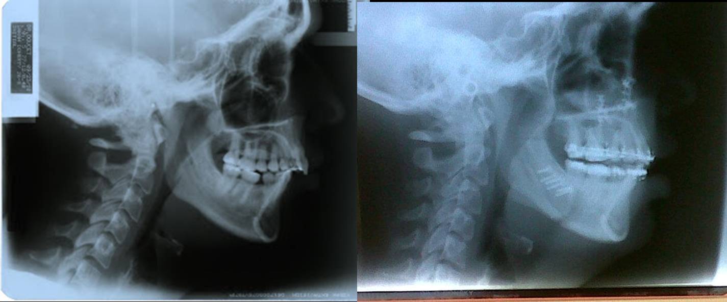 Surgery X Ray