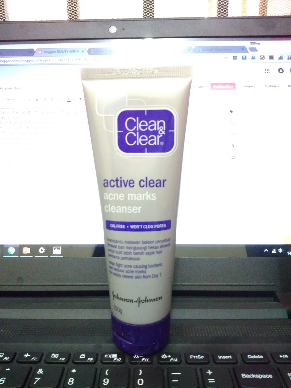 MY ACNE STORY with Clean n Clear 'acne marks cleanser'