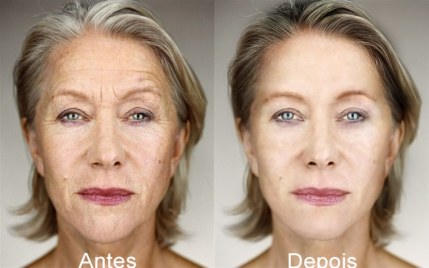 морщины на лице. морщины ярости. приложение убрать морщины. приложение убрать морщины. приложение убрать морщины.