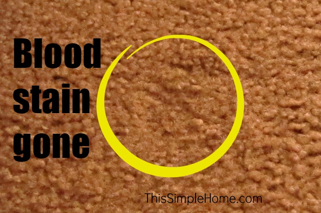 remove blood stains with peroxide