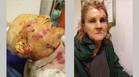 Elderly farm couple attacked