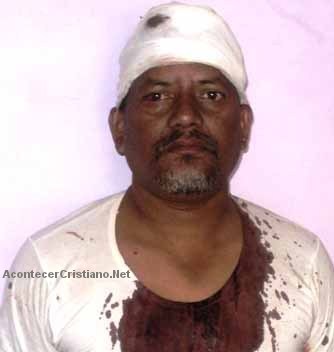 Lal Mani Prasad, pastor golpeado en la India