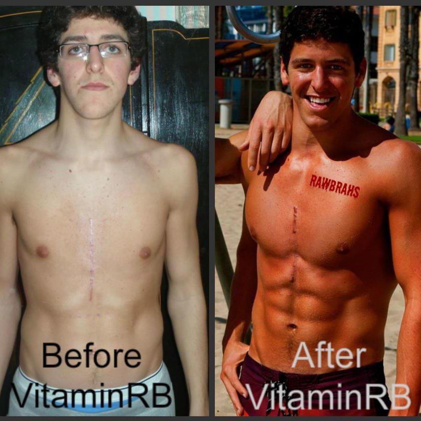 Bodybuilders Zinc Other Than Herbal Components In Penis Pills