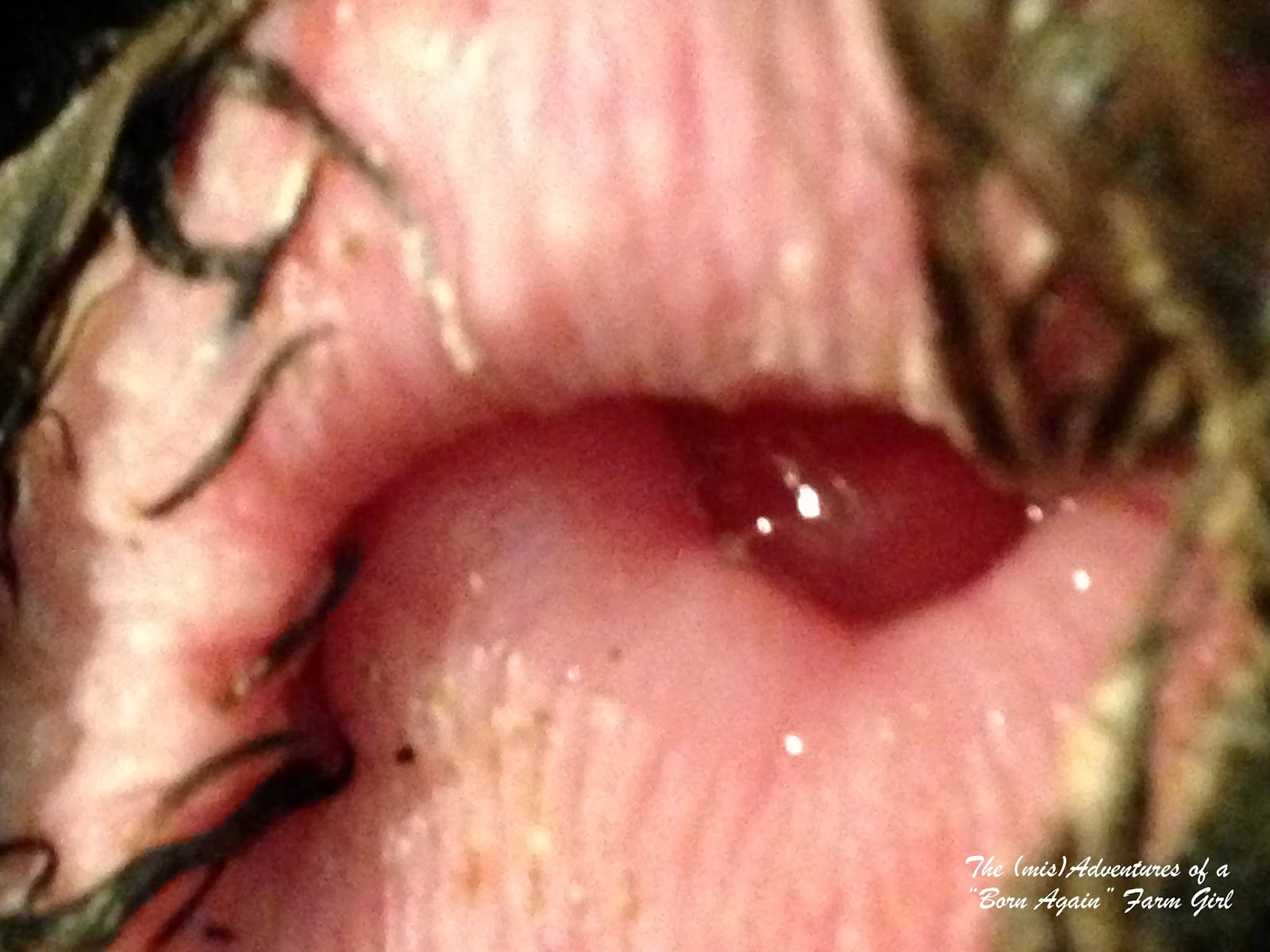 Prolapse Shit Prolapse Shit