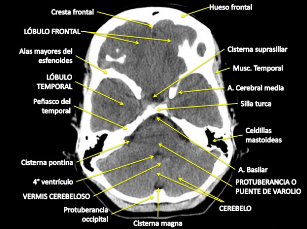 DIPLOMADO AEROMEDICINA : LABORATORIO Y ESTUDIOS DE GABINETE