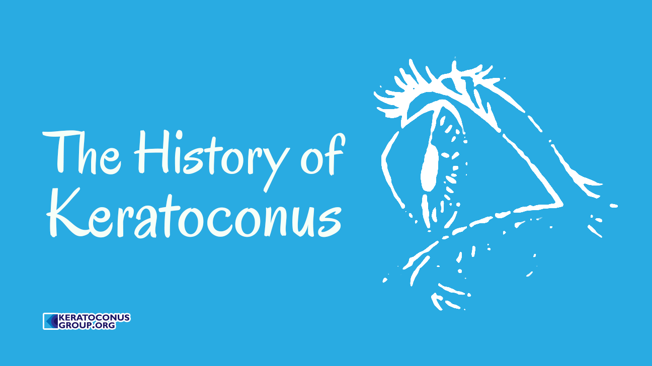 The History of Keratoconus - Drawing by James Wardrop (1808)