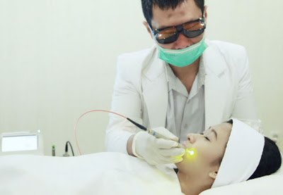 cara menghilangkan bekas luka medis laser