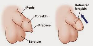 Problems With Uncircumcised Penis 105