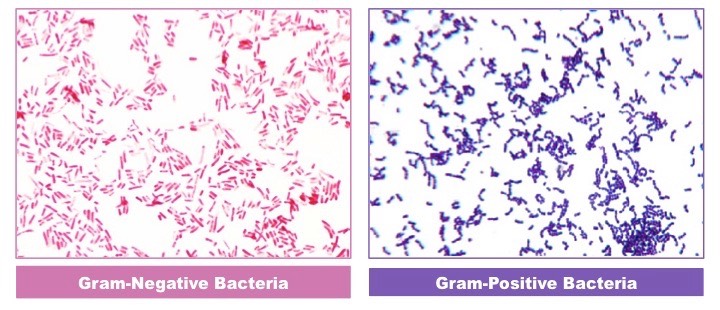 Gram Staining Microbiology Laboratory Turkey