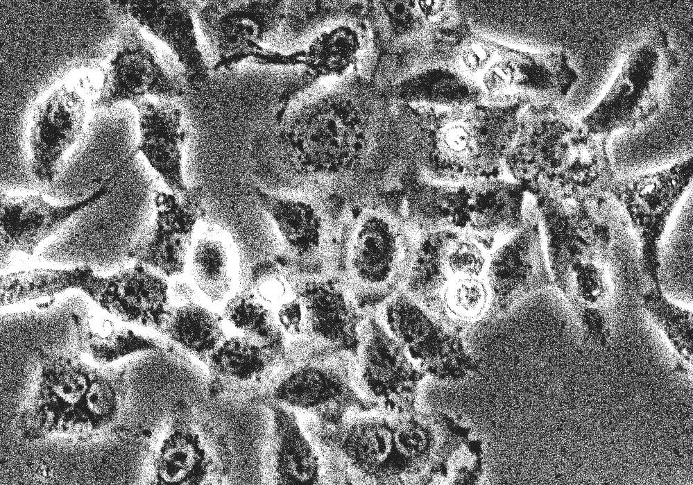 HEK 293 Cells Human Embryonic Kidney Cells