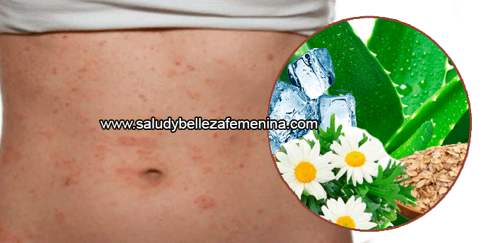 Remedio natural para el sarpullido en la piel