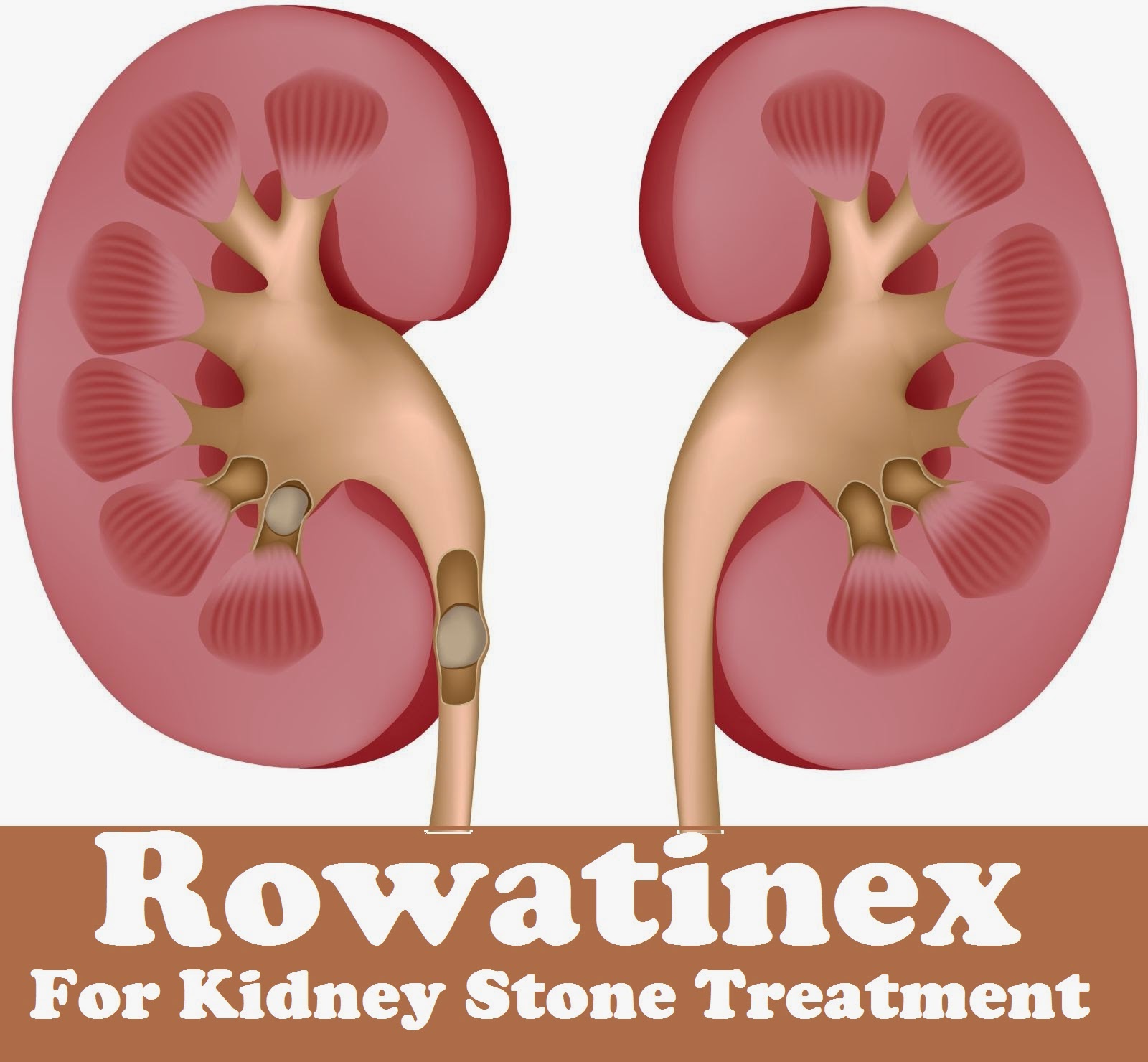 Rowatinex Side Effects To Pregnant 13
