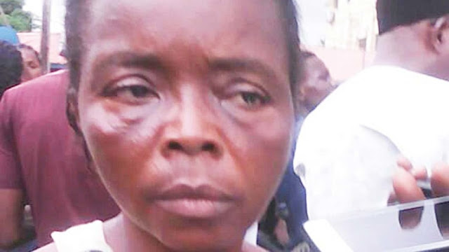 diabetes gbemisola oseni