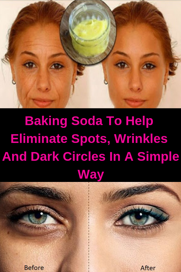 Baking Soda To Help Eliminate Spots, Wrinkles And Dark Circles In A