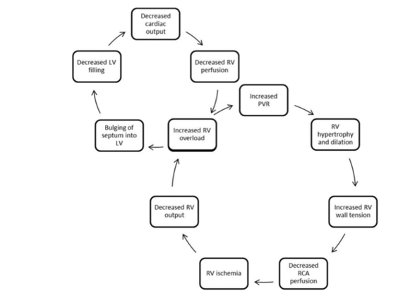 pulmonary hypertension