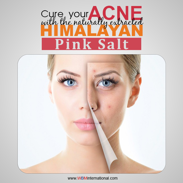 Cure your acne with the naturally extracted Himalayan pink salt
