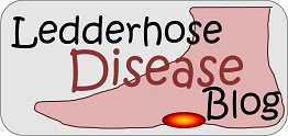 Ledderhose Disease Blog