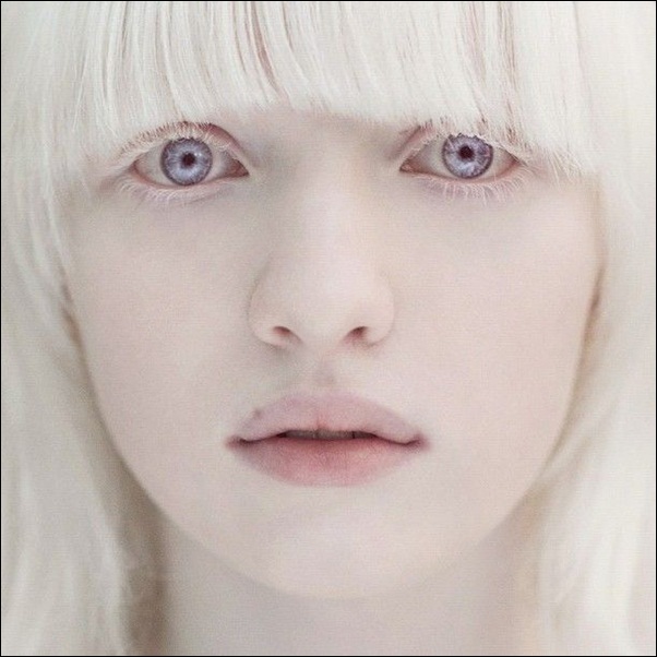 Conheça Nastya, menina albina mais linda do mundo