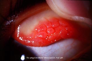 Purulent surgery essays 06 picture