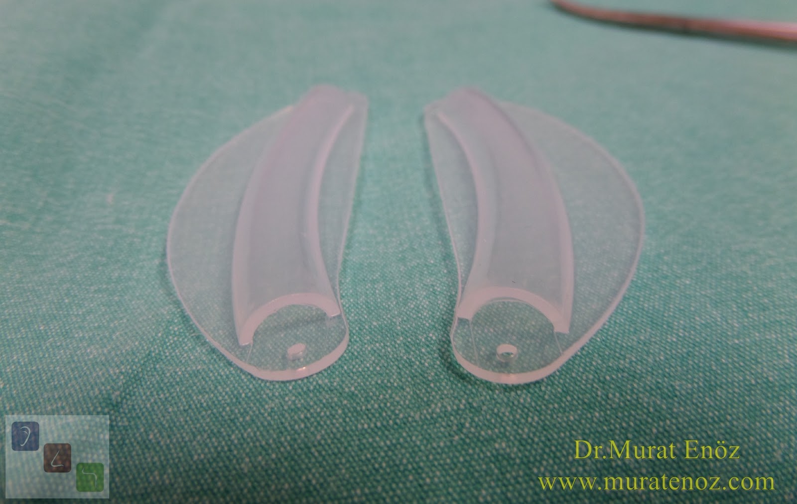 Rhinoplasty Recovery Guide 👃 34 Internal Nasal Splints Removal