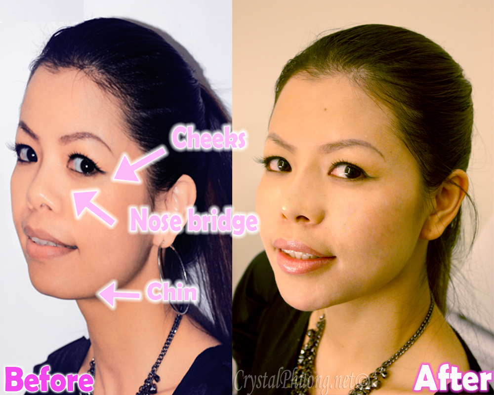 THE BEST AND SAFEST WAY TO TRANSFORM YOUR FACE CrystalPhuong