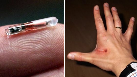 Teólogo alerta que microchip puede ser preparación para marca de la bestia. Teólogo alerta que microchip puede ser preparación para marca de la bestia.