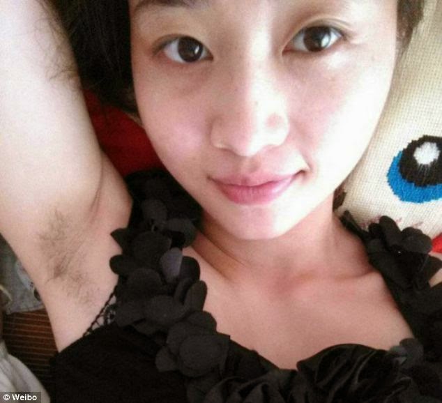 สาเหตุที่ทำให้รักแร้ดำ สาเหตุที่ทำให้รักแร้ดำ