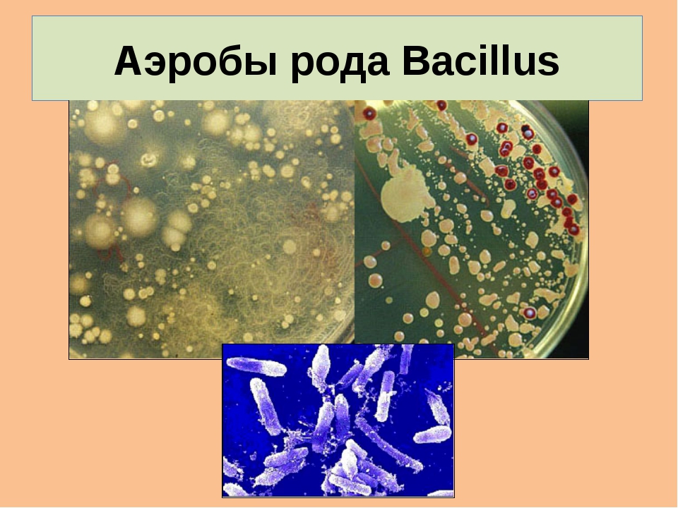 аэробы примеры микроорганизмов. классификация бактерий по дыханию. бактерии аэробы и анаэробы. способы дыхания животных. анаэробная и аэробная микрофлора.